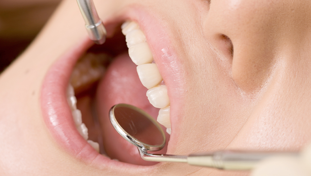 市川市行徳駅前のシーラント