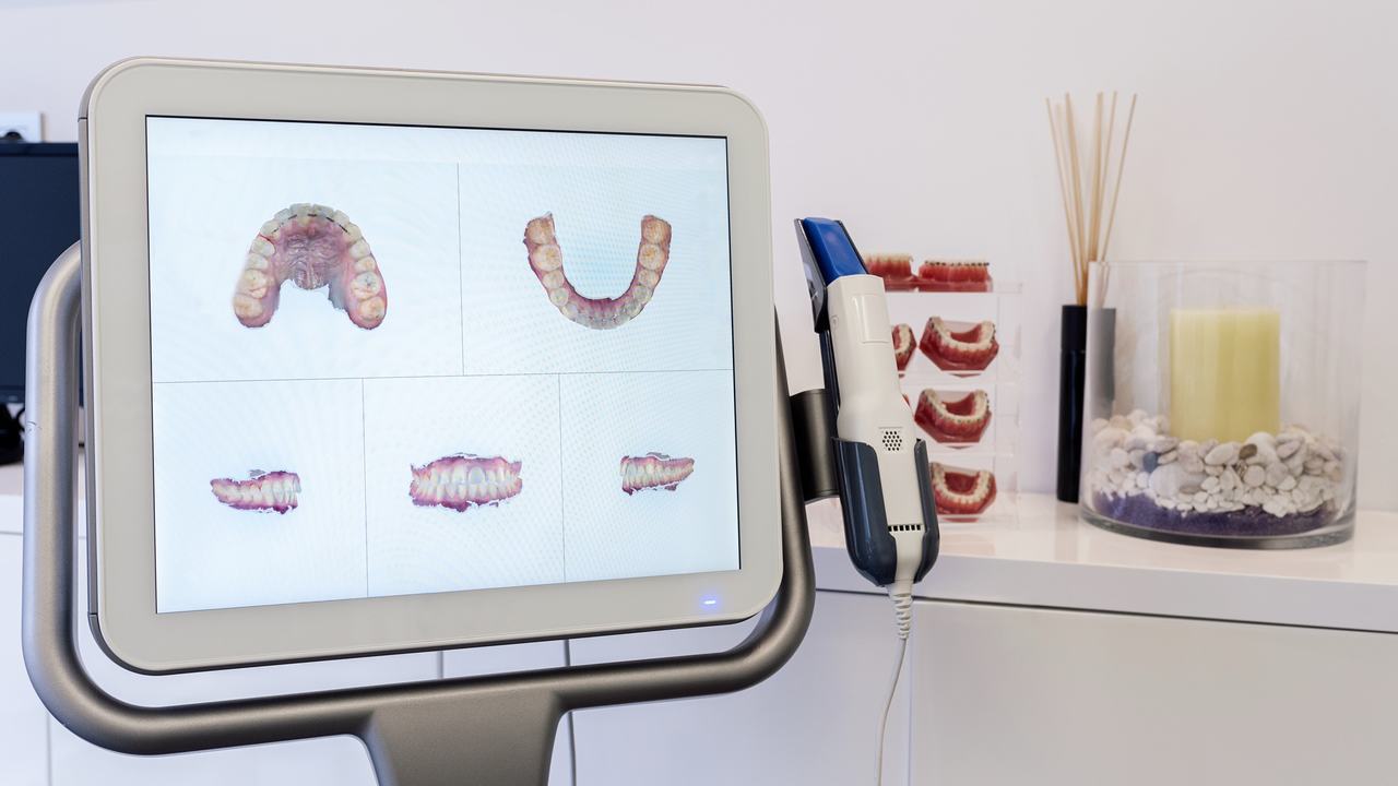 市川市行徳駅前のインビザラインファースト（子供のマウスピース矯正）