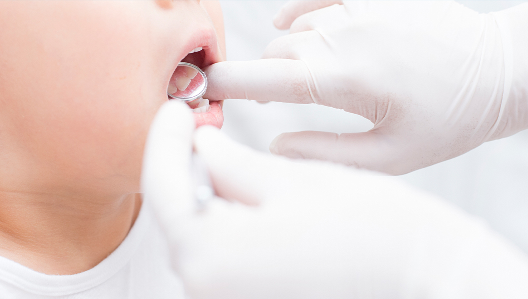 市川市行徳駅前のシーラント