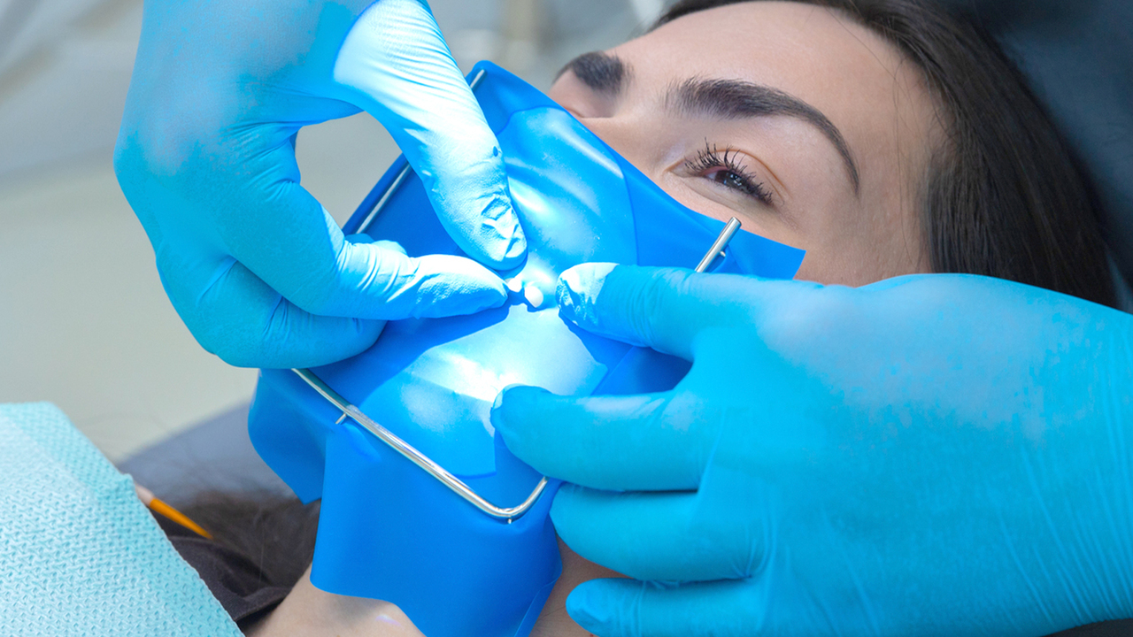 市川市行徳駅前の根管治療