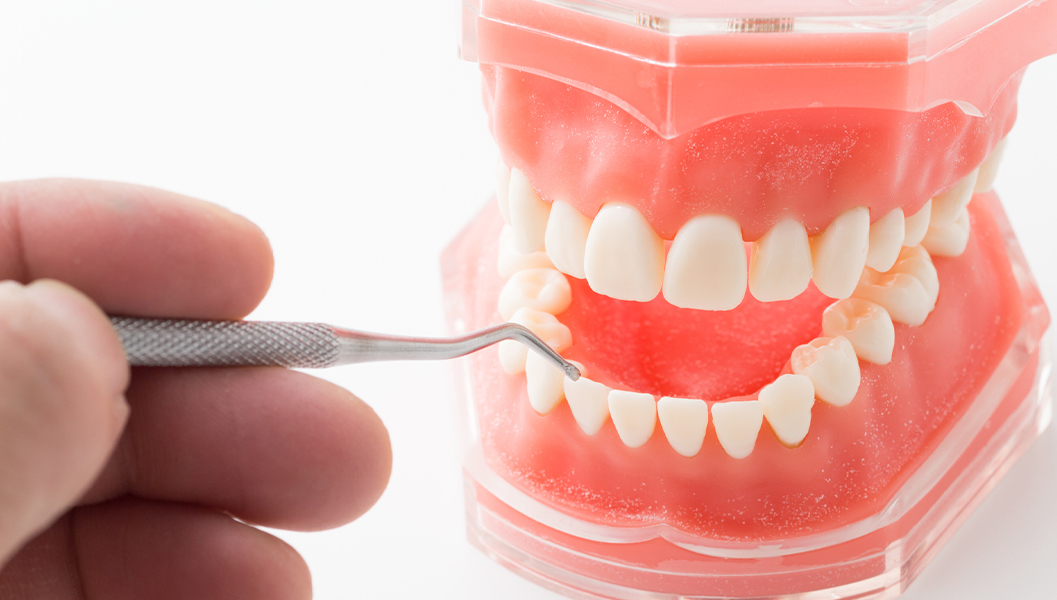 市川市行徳駅前のホームホワイトニング